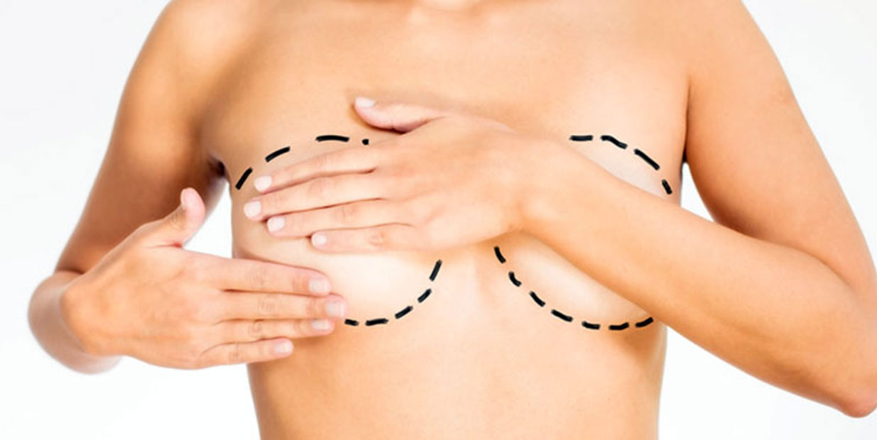 Reconstruction des seins par DIEP (lambeau abdominal) - Docteur ...