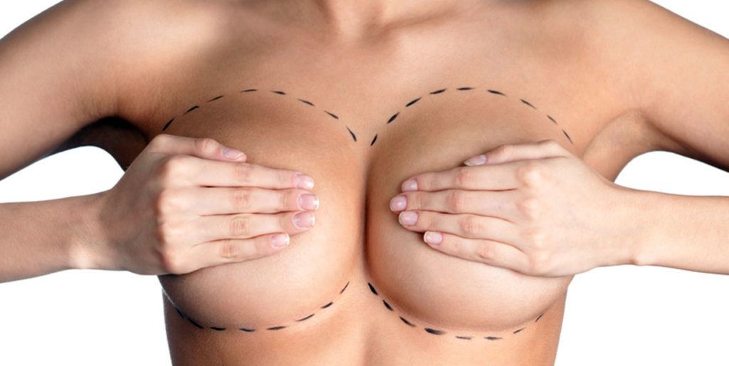 Augmentation mammaire par prothèses à Paris - Dr Ozil